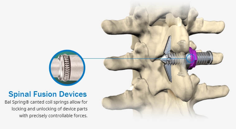 Spinal Implant